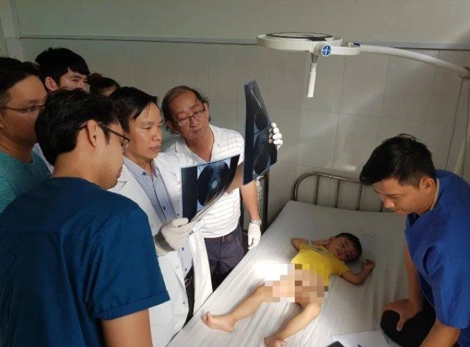 Hội chẩn phim X-quang bệnh nhi tại khoa Ngoại