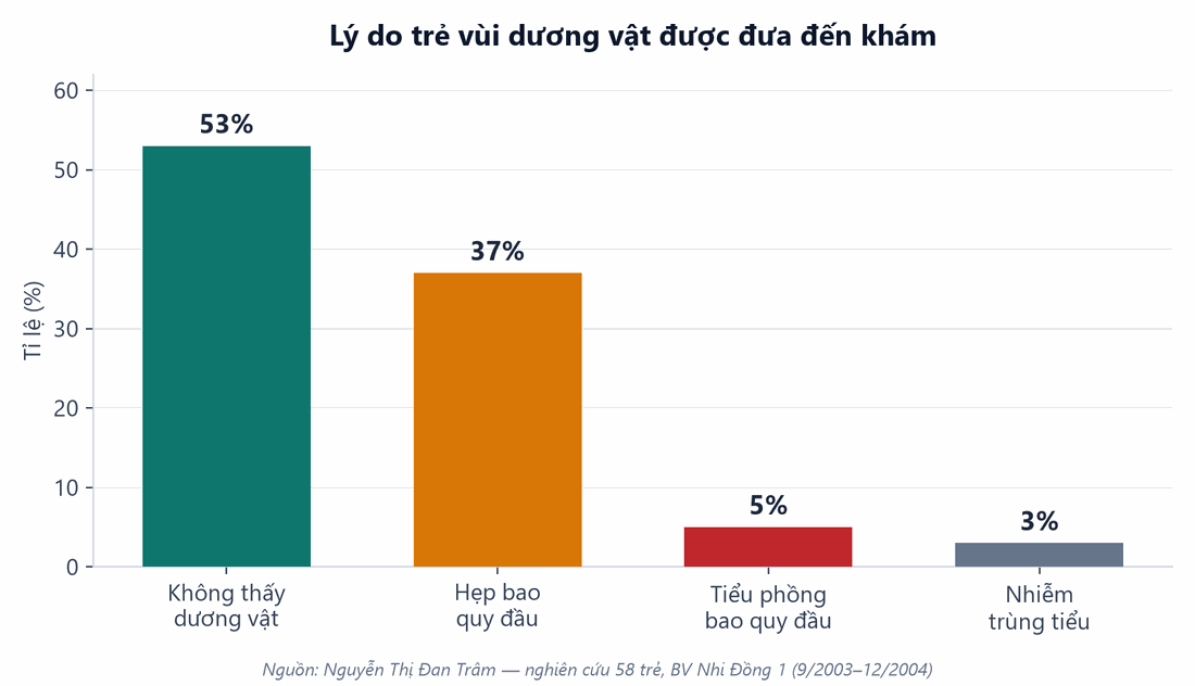 Biểu đồ lý do trẻ vùi dương vật được đưa đến khám: không thấy dương vật 53%, hẹp bao quy đầu 37%, tiểu phồng bao quy đầu 5%, nhiễm trùng tiểu 3%